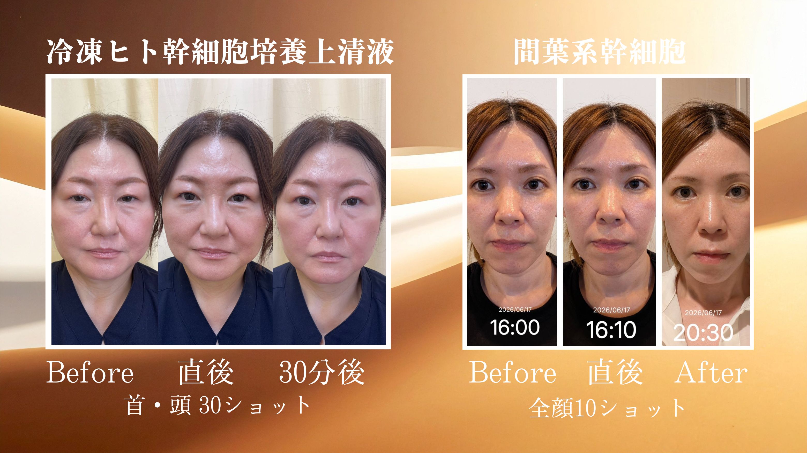 ダウンロード